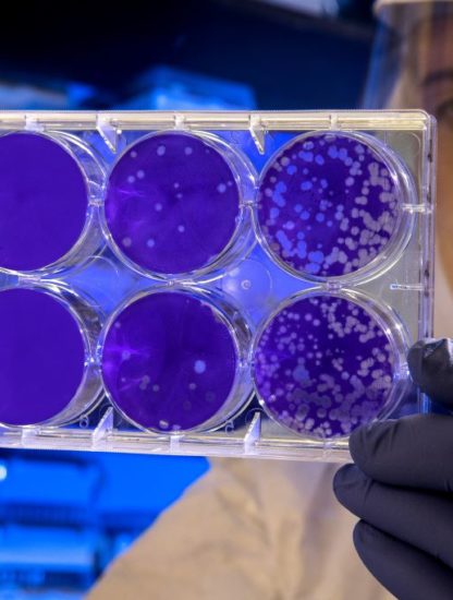 Inteligencia Artificial: la solución contra el coronavirus